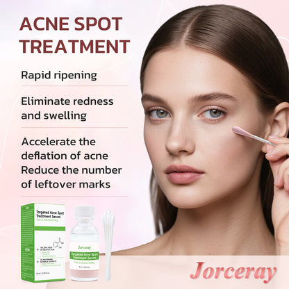Acne Drying Lotion, 29ml / 0.98 fl.oz.