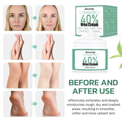 40% Urea Foot Cream, 150ml / 5.3 fl.oz.
