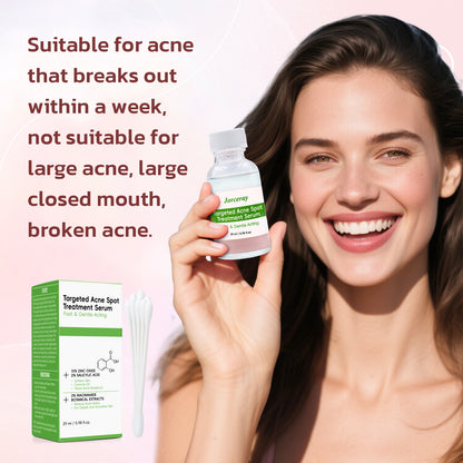 Acne Drying Lotion, 29ml / 0.98 fl.oz.